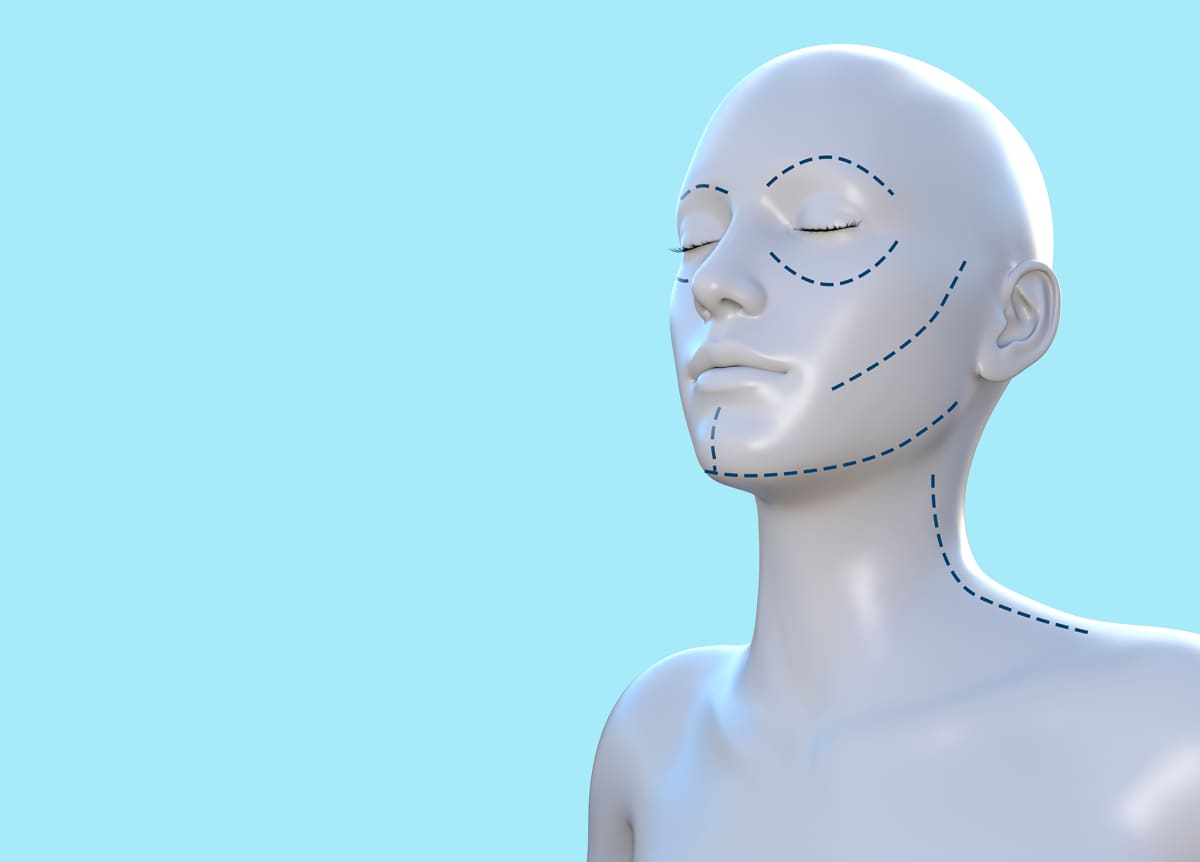 整容
