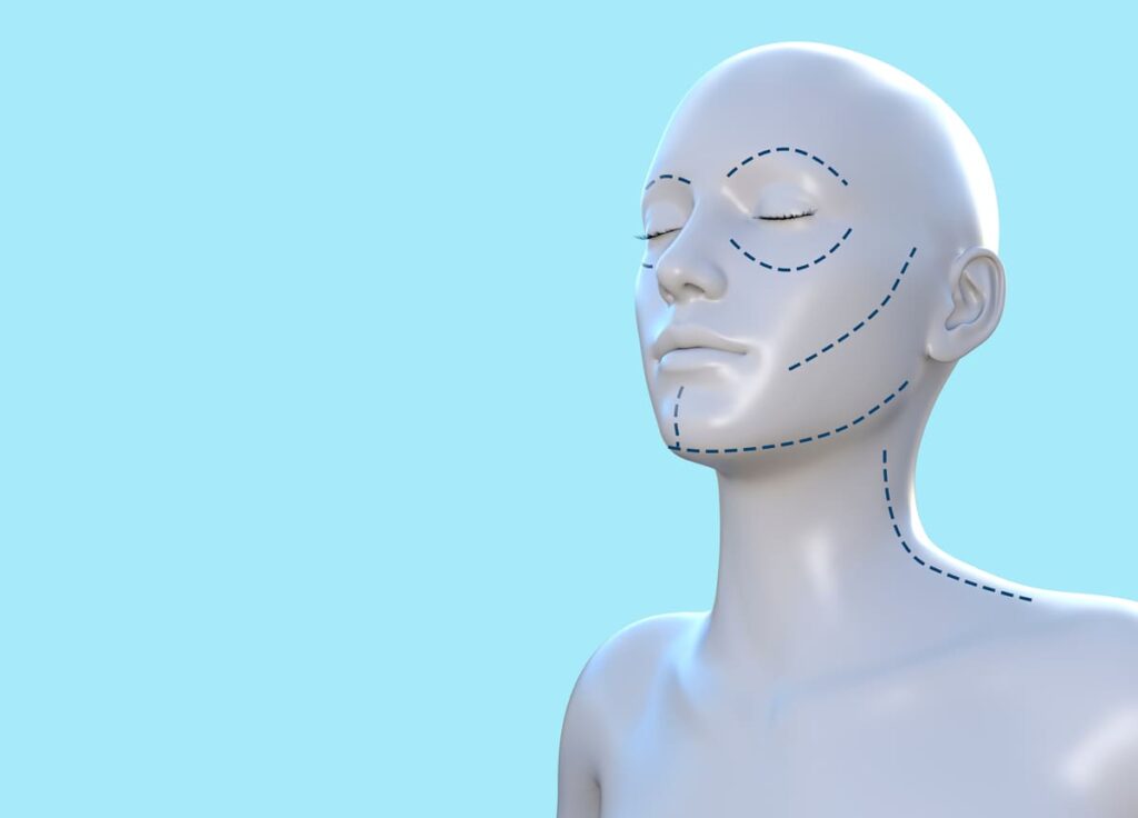 整容