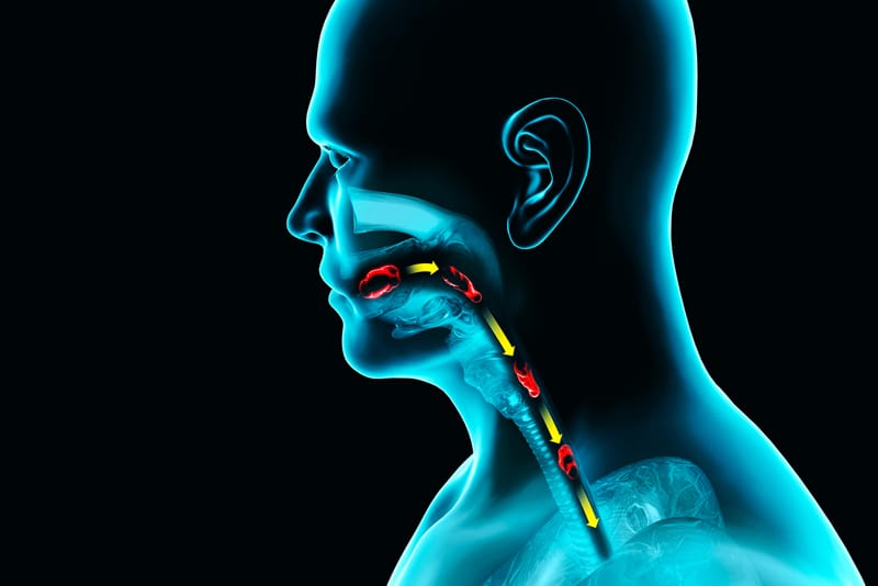 Swallowing disorders