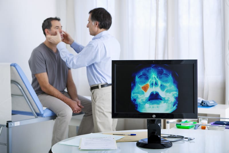 Nasopharyngeal carcinoma