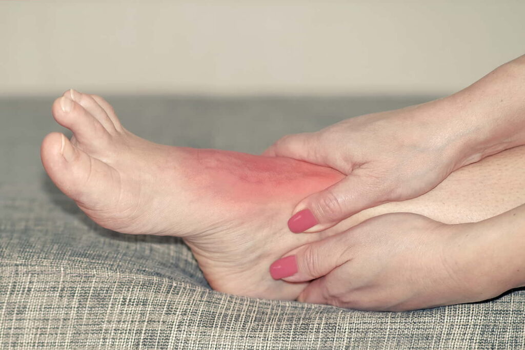 腳腕扭傷